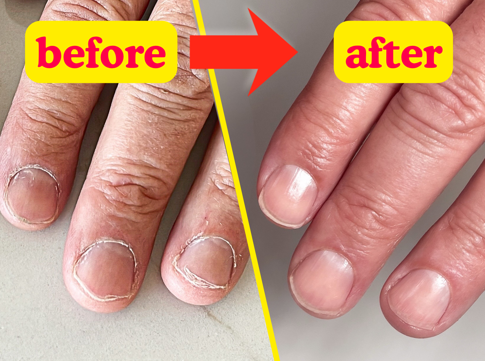 Why do my nails keep breaking? And why cuticle oil is the answer.