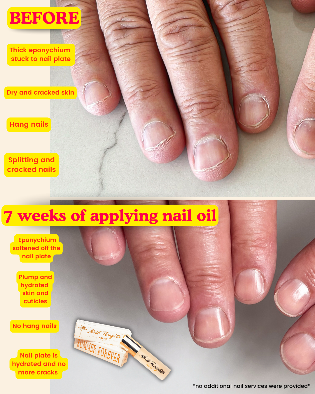 Summer Forever Nail Oil