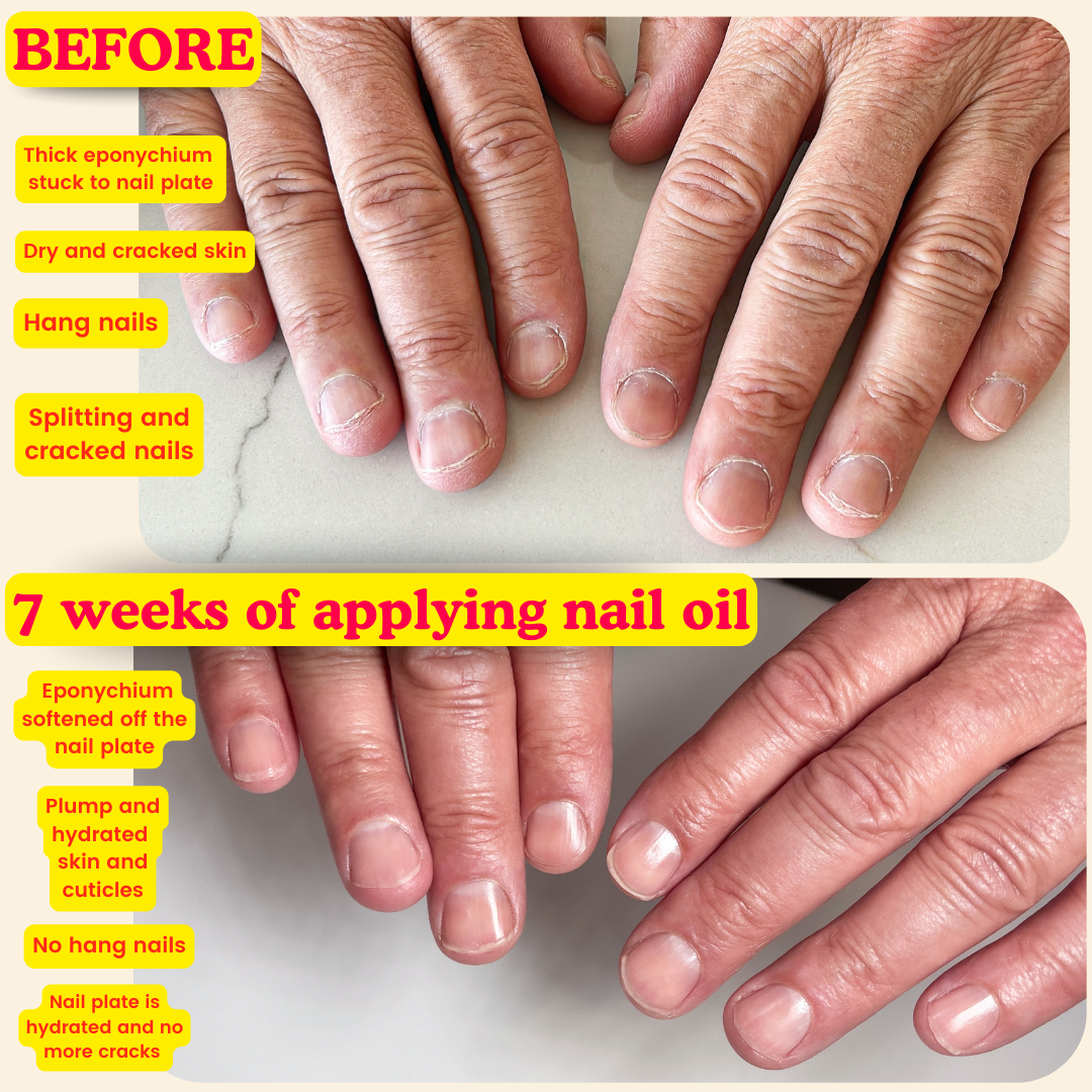 Summer Forever Nail Oil